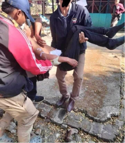 ကနန်ရွာလေကြောင်းတိုက်ခိုက်မှုအတွင်း ဒဏ်ရာရသူများကို ဆေးဝါးကုသခွင့်မရရှိစေရန် စစ်ကောင်စီ ကန့်သတ်ပိတ်ပင်ထား