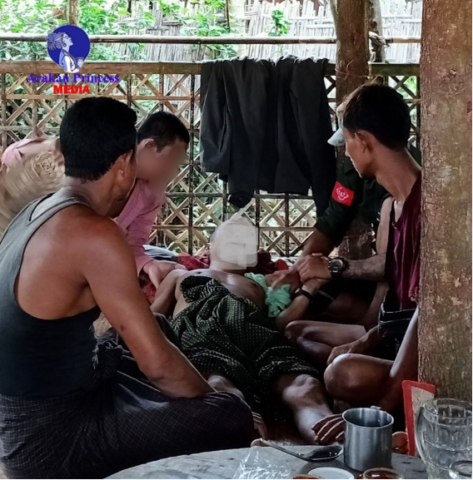 မင်းပြားမြို့နယ်တွင် ငှက်ဖျားဖြစ်ပွားမှုမြင့်တက်နေပြီး သေဆုံးသူ ၅ ဦးအထိရှိလာ